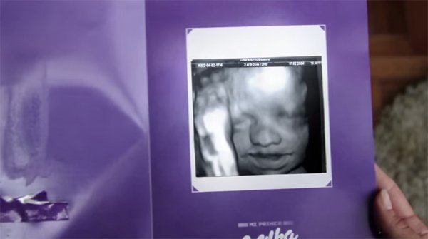 Milka-Ultrassom